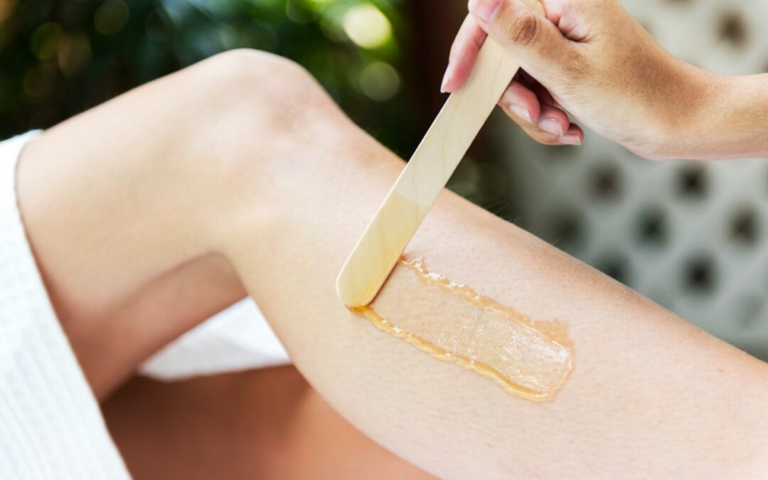Why You Might Experience Breakouts After Waxing
